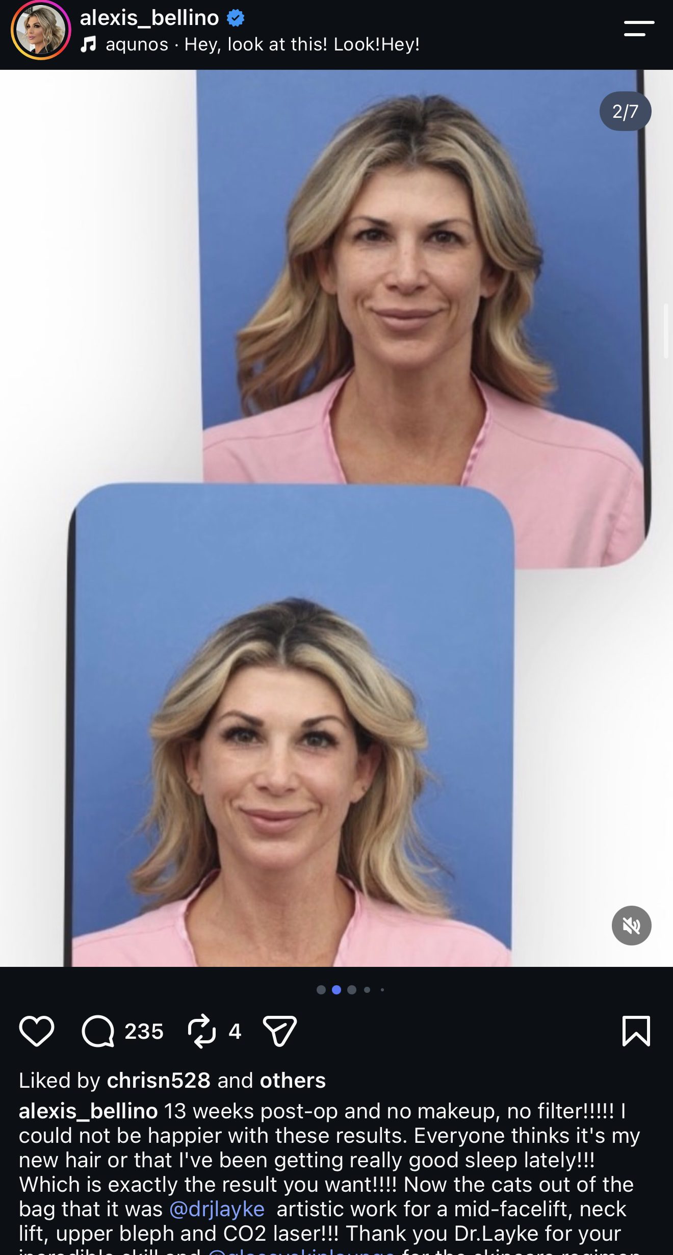 Alexis Bellino | Instagram